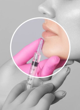 Kozmetik uzmanı, güzel bir kadının burun kıvrımlarında dudak büyütme ve kırışıklık önleyici iğneler yapar. Güzellik salonunda kadın kozmetolojisi.