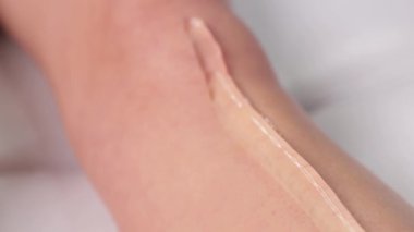 Bir kadının vücudunda epilasyon tüy çıkarma prosedürü. Güzellik uzmanı bir güzellik salonunda bacağının alt kısmında lazer gençleştirme yapıyor. İstenmeyen vücut kılları alınıyor. Donanım ipl kozmetolojisi