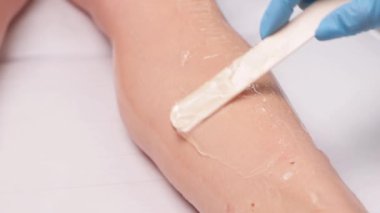 Bir kadının vücudunda epilasyon tüy çıkarma prosedürü. Güzellik uzmanı bir güzellik salonunda lazer gençleştirme yapıyor. İstenmeyen vücut kılları alınıyor. Donanım ipl kozmetolojisi