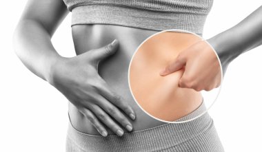 Kız karın derisini yüzüyor, vücut yağını gösteriyor. Aşırı kilonun tedavisi ve bertaraf edilmesi, deri altı yağ birikimi..