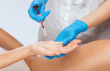 Kozmetik uzmanı bir kadının avuçlarında hiperhidroza karşı botulinyum toksini enjekte eder. Kadın kozmetolojisi, cilt bakımı.