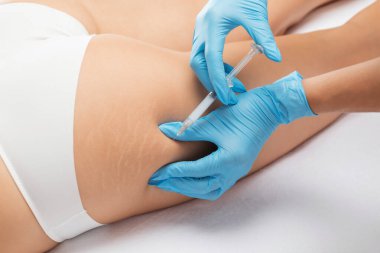 Estetik kozmetik uzmanı bir kadının vücudunda yağ yakmak için lipolitik enjeksiyon yapar. Güzellik salonunda kadın estetiği. Kozmetoloji konsepti..