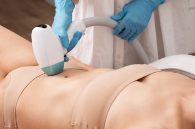 Bir kadının vücudunda epilasyon tüy çıkarma prosedürü. Güzellik uzmanı bir güzellik salonunda lazer gençleştirme yapıyor. İstenmeyen vücut kılları alınıyor. Donanım ipl kozmetolojisi