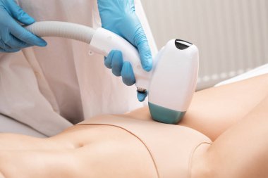 Bir kadının vücudunda epilasyon tüy çıkarma prosedürü. Güzellik uzmanı bir güzellik salonunda lazer gençleştirme yapıyor. İstenmeyen vücut kılları alınıyor. Donanım ipl kozmetolojisi