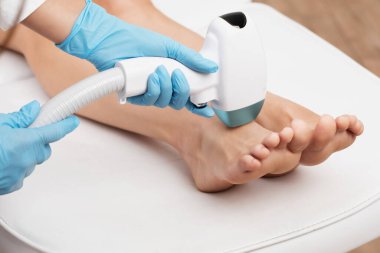Bir kadının vücudunda epilasyon tüy çıkarma prosedürü. Güzellik uzmanı bir güzellik salonunda lazer gençleştirme yapıyor. İstenmeyen vücut kılları alınıyor. Donanım ipl kozmetolojisi