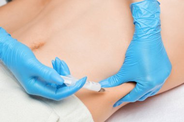 Güzellik uzmanı bir adamın karnında yağ yakmak için lipolitik enjeksiyon yapar. Güzellik salonunda erkek estetiği..