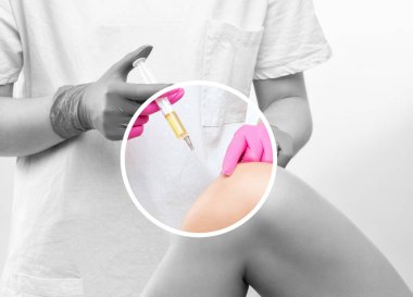 Yaralanmadan sonra bir hastanın dizinde kök hücre tedavisi yapan bir doktor. Diz ağrısını trombosit zengini plazma enjeksiyonuyla tedavi ediyorum. Eklem iltihabı ve osteoartrit tedavisi. Tıbbi ve kozmetik konsepti..