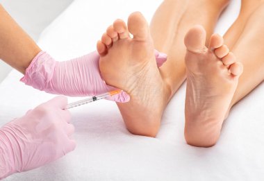 Doktor kozmetik uzmanı bir kadının ayaklarına botulinyum toksini enjekte eder. Klinikte hiperhidroz tedavisi.