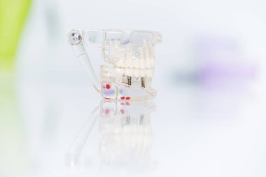 Diş macunları diş hekimliğinde dişleri düzeltmek için diş telleri hizalanıyor..