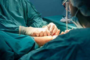 Bir ameliyathanede narin bir el ameliyatı gerçekleştiren yardımsever bir cerrah. Tıbbi, Sağlık ve Cerrahi Hassas Konseptler