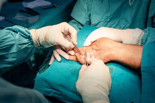 Faglærte Kirurgiske Hender Sterile Hansker Utfører Nøyaktig Suturering Pasients Hånd – stockfoto