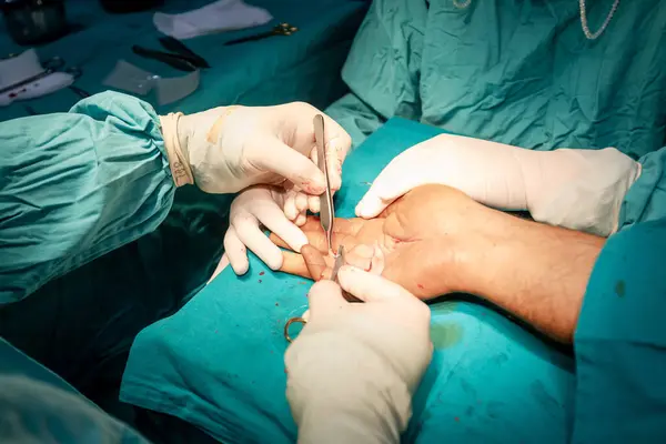 Mãos Cirurgião Hábil Luvas Estéreis Realiza Sutura Precisa Mão Paciente — Fotografia de Stock
