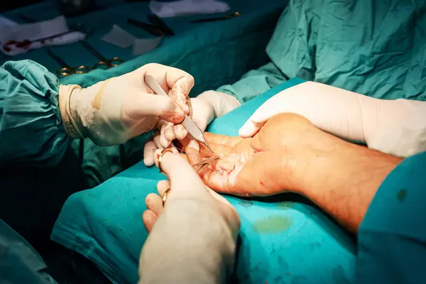 Mãos Cirurgião Hábil Luvas Estéreis Realiza Sutura Precisa Mão Paciente — Fotografia de Stock