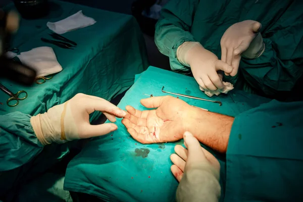 Vakkundige Chirurg Handen Steriele Handschoenen Voert Nauwkeurige Hechting Hand Van Stockfoto