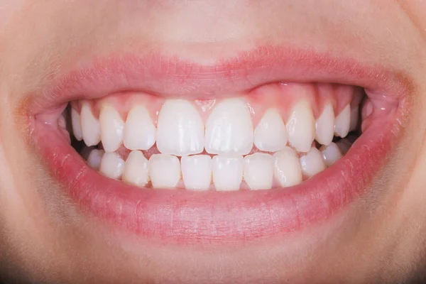 Strzał Nierozpoznawalnej Kobiety Uśmiechającej Się Jasno Zębami Przed Wykonaniem Ortodonty — Zdjęcie stockowe