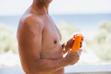 Close-up of a man's shoulder with sunburn. The skin sloughs off its his burn skin. It is the cause of melanoma.