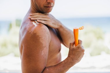 Close-up of a unrecognizable man applying suntan lotion to his sunburned shoulder.