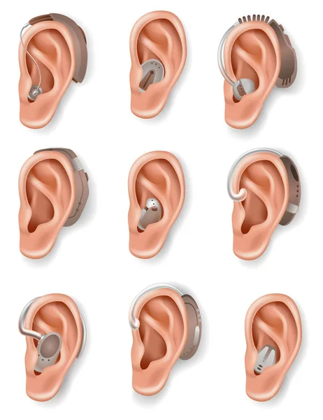 Hörapparat Inställd Ljudförstärkare För Hörselskadade Patienter Medicin Och Hälsa Realistiskt — Stock vektor