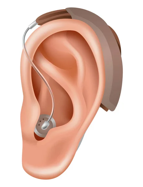 Audífono Amplificador Sonido Para Pacientes Con Pérdida Auditiva Medicina Salud — Vector de stock