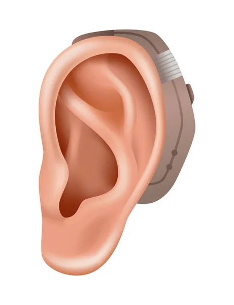 Hearing Aid Sound Amplifier Patients Hearing Loss Medicine Health Realistic — Stock Vector