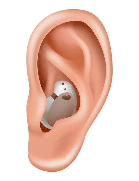Hallókészülék Hangerősítő Halláskárosodásban Szenvedő Betegek Számára Gyógyszer Egészség Reális Tárgy — Stock Vector