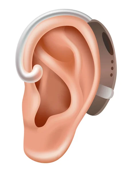 보청기 청력을 환자에게 증폭기를 요법으로 치료하고 보조하는 — 스톡 벡터