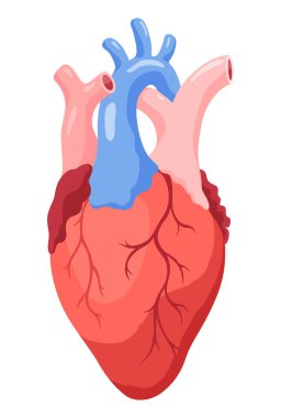 Ateroskleroz aşaması. Kalp krizinin anatomisi. Arteriosklerotik vasküler hastalık veya ASVD. Beyaz arkaplanda vektör illüstrasyonu.