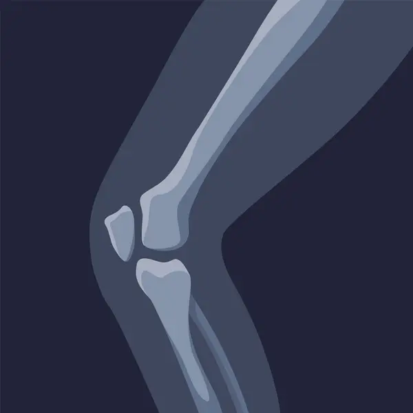 人間の骨の整形外科および骨格のアイコン 人間の関節の骨X線イメージ 解剖学の骨格の平らな設計のベクトル イラスト ロイヤリティフリーのストックイラスト