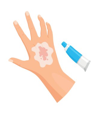 Hands injured skin and procedures of wound cleaning. First aid for wound. Medicine cure or treatment. First emergency help for human hand trauma.