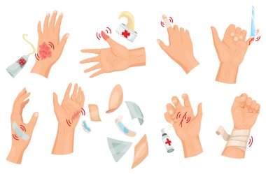 Eller yaralı cilt, bandaj ve yara temizliği prosedürleri. Yara için ilk yardım. İlaç tedavisi ya da tedavi. İnsan el travması için ilk acil yardım..