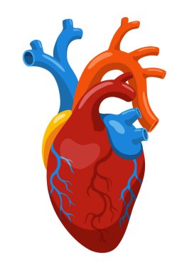 Atherosclerosis stage. Anatomy of heart attack. Arteriosclerotic vascular disease or ASVD. Vector illustration on white background. clipart