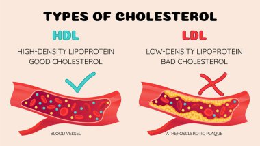 İnsan kan damarlarında kolesterol türleri. Hastalıkları açıklamak için normal ve daralmış arter. Yüksek yoğunluklu Lipoprotein HDL ve Düşük Yoğunluklu Lipoprotein LDL. Vektör illüstrasyonu.