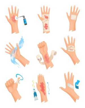 Eller yaralı cilt, bandaj ve yara temizliği prosedürleri. Yara için ilk yardım. İlaç tedavisi ya da tedavi. İnsan el travması için ilk acil yardım..