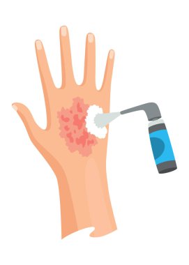 Eller yaralı cilt ve bandaj prosedürleri. Yara için ilk yardım. İlaç tedavisi ya da tedavi. İnsan el travması için ilk acil yardım..