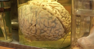 Gerçek insan beyni. Beyin anatomisi, gri madde, gri madde, kortikal gri. Tıbbi araştırma için formaldehit içeren cam kavanozdaki insan beyni.