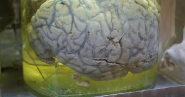 Mataradaki insan beyni. Tıbbi araştırmalar için formaldehitli cam kavanozda insan beyni. Beyin anatomisi, beyin kıvrımları, beyin kıvrımları. Beyin fıçıda.