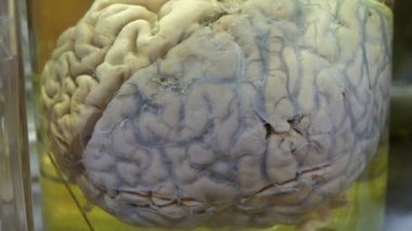 Mataradaki insan beyni. Beyin anatomisi, beyin kıvrımları, beyin kıvrımları. Tıbbi araştırmalar için formaldehitli cam kavanozda insan beyni. Fıçıdaki beyin.