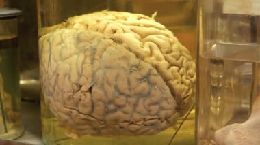 Gerçek insan beyni. Beyin anatomisi, gri madde, gri madde, kortikal gri. Tıbbi araştırma için formaldehit içeren cam kavanozdaki insan beyni.