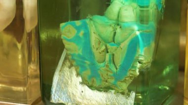 Mavi inek beyni şişede. Sığır beyinli. Beyin anatomisi, beyin kıvrımları, beyin kıvrımları. Tıbbi araştırmalar için formaldehit içeren cam kavanozdaki hayvan beyni. Sığır beyninin kısmi görüntüsü