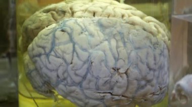 Mataradaki insan beyni. Fıçıdaki beyin.