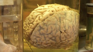 Gerçek insan beyni. Beynin anatomisi. Tıbbi araştırma için formaldehit içeren cam kavanozdaki insan beyni.