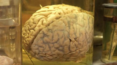 Mataradaki insan beyni. Beyin anatomisi, beyin kıvrımları, serebral hemisferler, beyin kıvrımları. Tıbbi araştırmalar için formaldehitli cam kavanozda insan beyni. Fıçıdaki beyin.