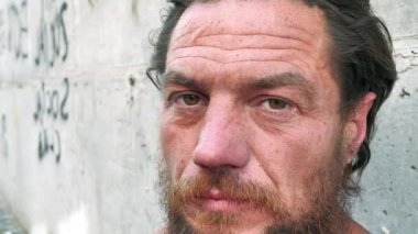 Gerçek evsiz bir adamın yavaş çekim yüzü. Sabit bir ikameti olmayan gerçek bir insan. Sokaklarda bir aşağı bir yukarı gezen biri. Bozulmuş adam kameraya bakıyor, sosyal aşağılanma.