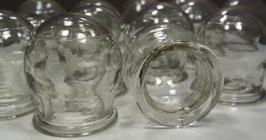 Tıbbi amaçlar için cam bardaklar, rehabilitasyon, artan kan akışı, lenfatik drenaj, sırt tedavisi. Halk dilinde kullanılan alternatif ilaçlar, kupa masajı, vakum terapisi. Sinema 4K videosu