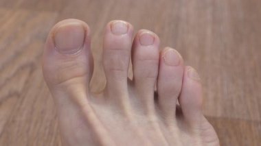 Yetişkin bir adamın ayağı ve ayak parmakları. Kesilmemiş tırnakları olan bir erkek ayağı. Adam ayak parmaklarını oynatıyor.