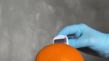 Kozmetik Derma Roller turuncu bir Cilt Konsepti üzerinde yuvarlanıyor. Dermaroller