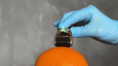 Kozmetik Derma Roller turuncu bir Cilt Konsepti üzerinde yuvarlanıyor. Dermaroller