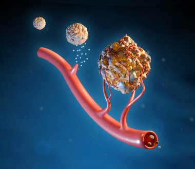 Cancer cells using angiogenesis to grow and spread through the body. Digital illustration, 3D render. clipart