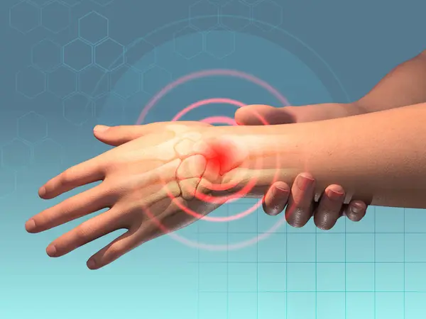 Wrist pain caused by traumas or other health issues. Digital illustration, 3D render.