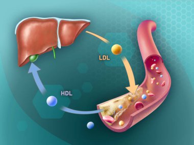 Yüksek yoğunluk ve düşük yoğunluklu lipoproteinler atardamar plağından kolesterol ekleyip çıkarıyor. Dijital illüstrasyon, 3B canlandırma.